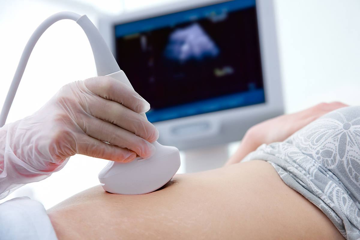 Woman getting an ultrasound on her belly.