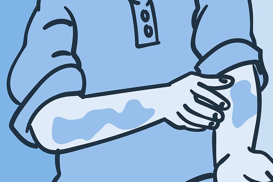 Illustration of a man looking at a rash on his arms.